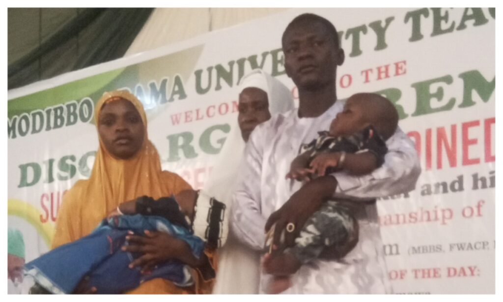 Yola Hospital Discharges Conjoined Twins After Successful Separation Surgery