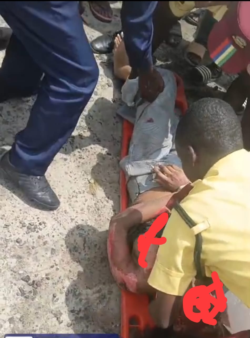 Lagos Accident: Hit-and-Run Driver Flees After Woman Sustains Serious Injuries